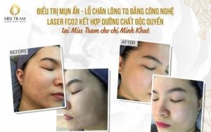 dạng content quảng cáo spa trước sau